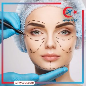 افضل مراكز التجميل في تركيا .. تفاصيل مهمة 